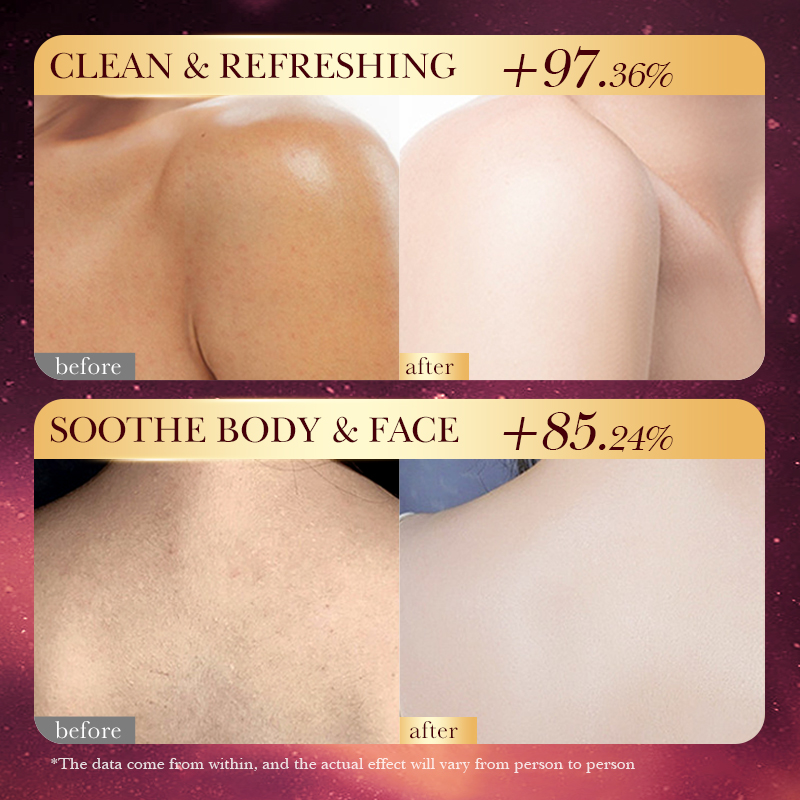 Rose Gold Foil Handmade Soap – - Luxury Skincare Essential 评论和价格